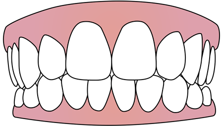 tooth_10.png